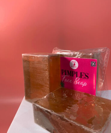 Acne Treatment Face Bar